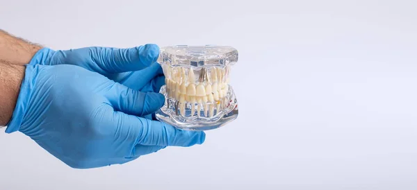 Zubní Ortodontický Zubní Model Dásněmi Zubní Sklovina — Stock fotografie