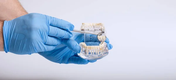 Dłoni Dentyści Dentyści Zębów Modelu Nauczania Pokazując Każdy Ząb Guma — Zdjęcie stockowe