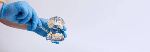 Die Hand Des Arztes Blauen Handschuhen Hält Ein Zahnmodell Auf — Stockfoto