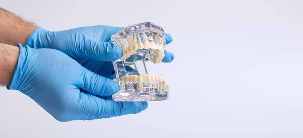Modelo Ensino Odontológico Odontológico Com Gengivas Esmalte Dentário — Fotografia de Stock