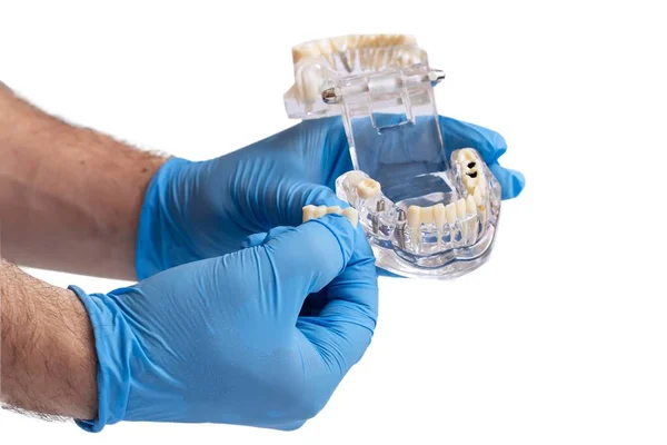 Mão Dentistas Dentes Dentários Modelo Ensino Mostrando Cada Dente Goma — Fotografia de Stock