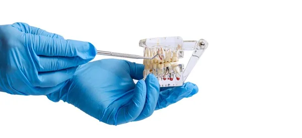 Hand Dentists Dental Teeth Teaching Model Showing Each Tooth Gum — Stock fotografie