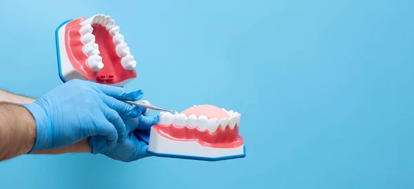 Dłoni Dentyści Dentyści Zębów Modelu Nauczania Pokazując Każdy Ząb Guma — Zdjęcie stockowe