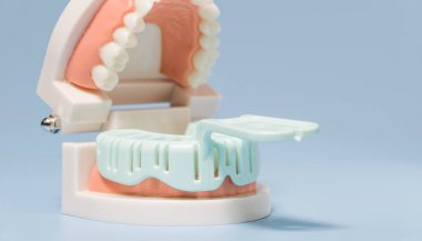 Close-up of a dental impression tray placed on a teeth model, used for dental mold making, training, and educational purposes.