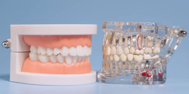 Close-up of two dental models, one opaque and one transparent, illustrating tooth structure, root canals, and oral anatomy for educational purposes.