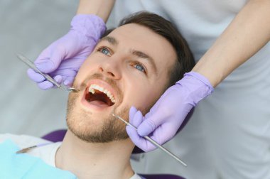 Periodontal Hizmetler. Gülümseyen Adam Stomatolojik Klinikte Tedavi Görürken, Diş Hekimliği Doktoru Erkek Hastaların Dişlerini İncelemek için Diş Hekimliği Aletleri Kullanıyor.