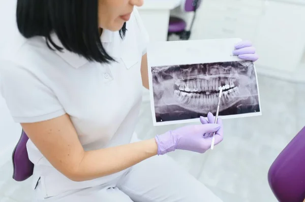 Zahnarzt Erklärt Seinem Patienten Der Klinik Die Details Eines Röntgenbildes — Stockfoto