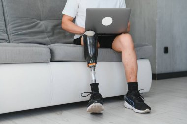 Evinde biyonik protez bacağı olan tanınmayan bir adamın yakın plan fotoğrafı..