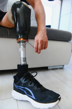 Dizinin üstünde protez bacak sakatlığı olan bir erkek bacak protezi, yakın plan. Ampütasyon engelli insanlar günlük hayatta.