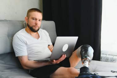 Diz üstü bacak protezi üzerinde protez bacak sakatlığı olan bir adam evde dizüstü bilgisayar kullanarak yapay bir cihaz kullanıyor. Ampütasyon engelli insanlar günlük hayatta.