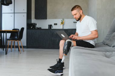 Diz üstü bacak protezi üzerinde protez bacak sakatlığı olan bir adam evde dizüstü bilgisayar kullanarak yapay bir cihaz kullanıyor. Ampütasyon engelli insanlar günlük hayatta.