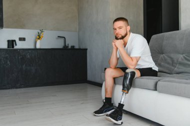 Dizinin üstünde protez bacak sakatlığı olan bir erkek bacak protezi, yakın plan. Ampütasyon engelli insanlar günlük hayatta.