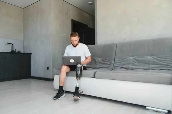 stock image Thoughtful young pensive man amputee with prosthetic leg disability above knee transfemoral leg prosthesis sitting on sofa at home. People with amputation disabilities everyday life.