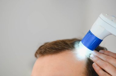 Bir tricholog, saç dökülmesine başlayan bir adamın saçını inceliyor. Bir dermatologla görüşeceğim. Saç dökülmesi, alopezi, pruritus, yanmakta olan kafa ya da sebora.