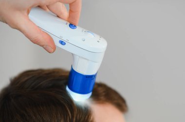 Genç bir adam trikop ile incelenir kafa derisi ve saç folikülleri durumu.