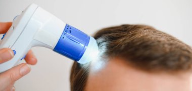 Genç bir adam trikop ile incelenir kafa derisi ve saç folikülleri durumu.