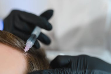 Yakışıklı bir adamın kuaförde saç bakımına gidişinin yan görüntüsü. Adam estetik kliniğinde mezoterapi görüyor, terapist eldiven takıyor kafa derisine iğne yapıyor, yakın çekim yapıyor.