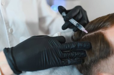Yakışıklı bir adamın kuaförde saç bakımına gidişinin yan görüntüsü. Adam estetik kliniğinde mezoterapi görüyor, terapist eldiven takıyor kafa derisine iğne yapıyor, yakın çekim yapıyor.