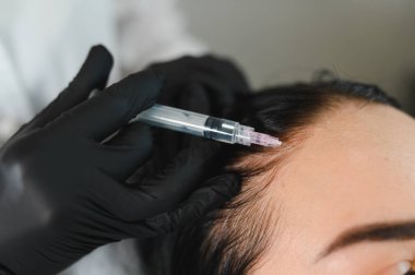 Kadın, profesyonel trikoloğundan saç terapisi görüyor. Saç büyümesi için iğne kullanılarak kozmetolojide saç tedavisi.