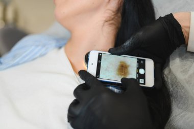 Dermatolog hastanın mol incelemesi yapıyor..