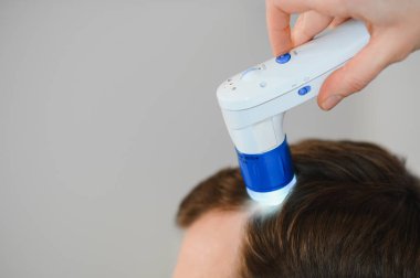 Bir tricholog, saç dökülmesine başlayan bir adamın saçını inceliyor. Bir dermatologla görüşeceğim. Saç dökülmesi, alopezi, pruritus, yanmakta olan kafa ya da sebora.