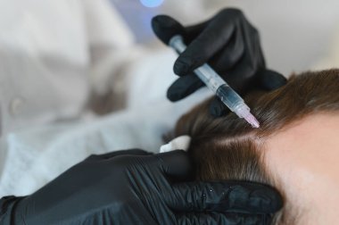 Yakışıklı bir adamın kuaförde saç bakımına gidişinin yan görüntüsü. Adam estetik kliniğinde mezoterapi görüyor, terapist eldiven takıyor kafa derisine iğne yapıyor, yakın çekim yapıyor.