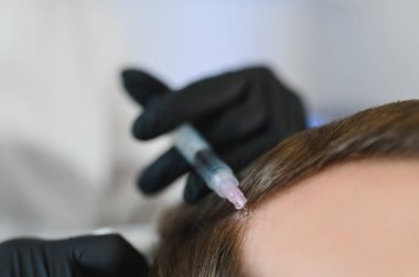 Adam kuaförde kuaförlük yapıyor, mezoterapi seansı yapıyor. Kadın terapist koruyucu eldiven verip şırınga yapıyor..