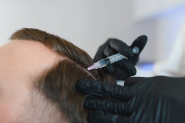 Yakışıklı bir adamın kuaförde saç bakımına gidişinin yan görüntüsü. Adam estetik kliniğinde mezoterapi görüyor, terapist eldiven takıyor kafa derisine iğne yapıyor, yakın çekim yapıyor.