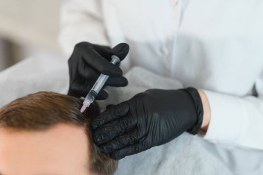 Yakışıklı bir adamın kuaförde saç bakımına gidişinin yan görüntüsü. Adam estetik kliniğinde mezoterapi görüyor, terapist eldiven takıyor kafa derisine iğne yapıyor, yakın çekim yapıyor.