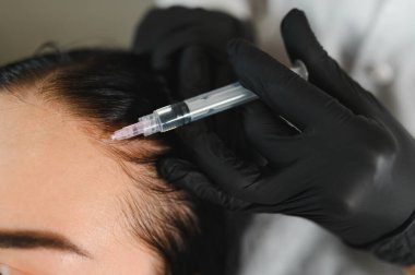 Saç problemi olan genç bir kadın klinikte iğne oluyor. Saç yenileme yenileme, şımartma prosedürü. Kozmetoloji, büyüyen foliküller, botulinyum tedavisi