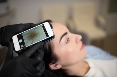 Doktor doğum lekeleri ve ben hastalarını inceliyor. Doğum lekeleri ve benler incelenir. Doktor hastanın benini inceler..