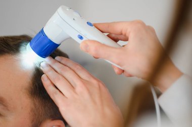 Genç bir adam trikop ile incelenir kafa derisi ve saç folikülleri durumu.