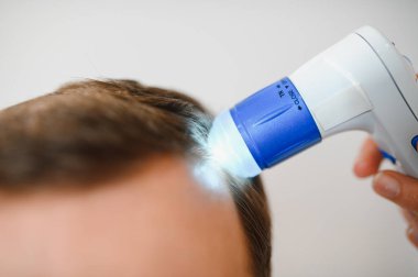 Bir tricholog, saç dökülmesine başlayan bir adamın saçını inceliyor. Bir dermatologla görüşeceğim. Saç dökülmesi, alopezi, pruritus, yanmakta olan kafa ya da sebora.