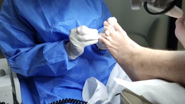 Профессиональный Специалист Педикюру Процедуры Использованием Ножницы Инструмент Глобусы Пациент Посещает — стоковое видео