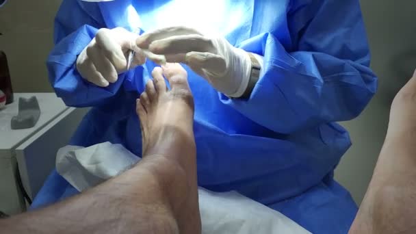 Profesjonalny Specjalista Chirurgii Pedicure Przy Użyciu Przyrządów Paznokci Globusów Pacjent — Wideo stockowe