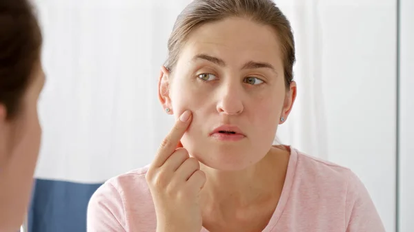 stock image Happy smiling woman looking at her face with pimples. Concept of female aging, skin issues, facial treatment and care