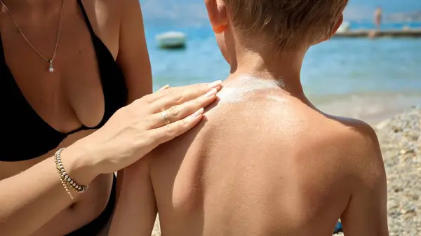 Close Mãe Esfregando Protetor Solar Creme Proteção Nas Costas Seu — Fotografia de Stock