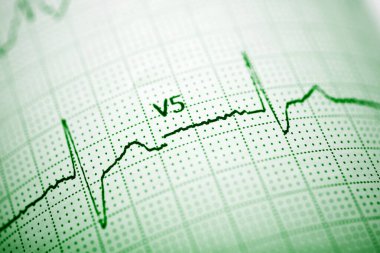 Elektrokardiyogram insan kalbinin nabzını gösteriyor.