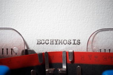 Ekşimoz kelimesi daktiloyla yazılmış..