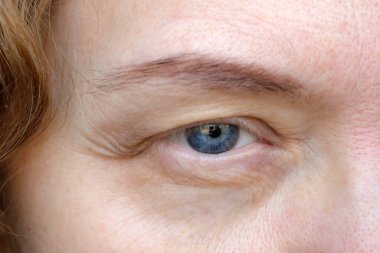 Makyaj yaparken göz kapağı sarkık orta yaşlı bir kadın gözü. Ptosis, göz kapağının üst kısmının sarkmasıdır, tembel göz. Kozmetik ve yüz konsepti, ilk kırışıklıklar, yakın çekim.