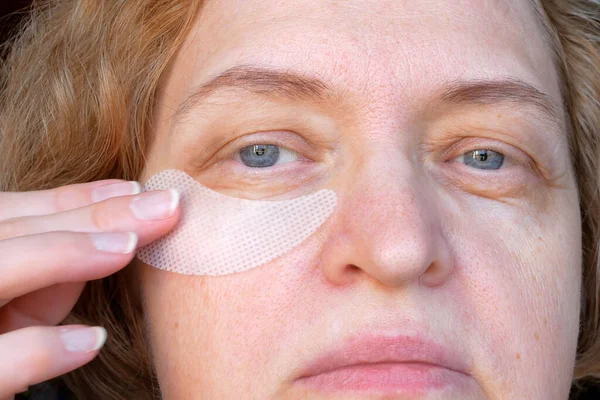Middle Aged Female Eye Drooping Eyelid Patch Eyes Ptosis Drooping — Stock Photo, Image