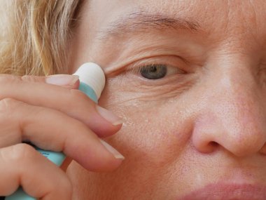 Masaj silindirli göz kremi ve orta yaşlı sarışın bir kadın, göz kapağı sarkmış orta yaşlı bir kadın gözü. Ptosis, göz kapağının üst kısmının sarkmasıdır, tembel göz. Yakın çekim