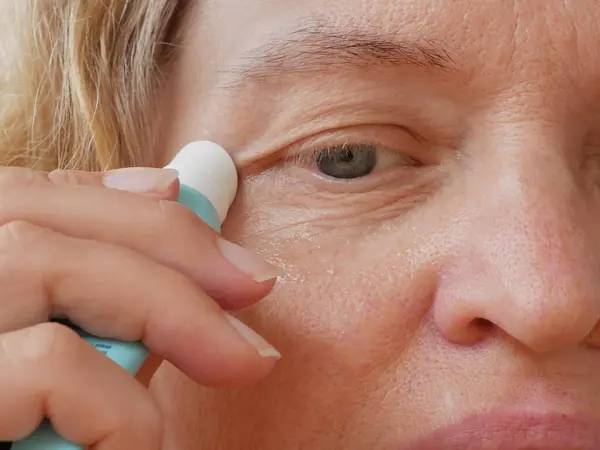 eye cream with massage rollers and blond woman middle-aged face, middle aged female's eye with drooping eyelid. Ptosis is a drooping of the upper eyelid, lazy eye.  closeup