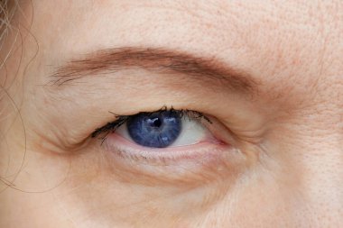 Göz kapağı sarkmış orta yaşlı kadın gözü kaş makyajı yapıyor. Ptosis, göz kapağının üst kısmının sarkmasıdır, tembel göz. Kozmetik ve yüz konsepti, ilk kırışıklıklar, yakın çekim.