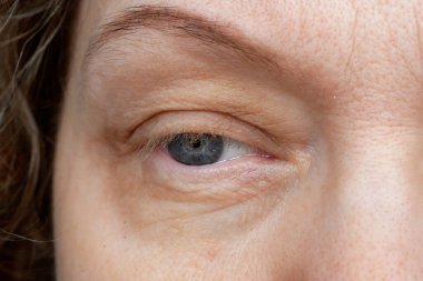 Göz kapağı sarkmış orta yaşlı kadın gözü kaş makyajı yapıyor. Ptosis, göz kapağının üst kısmının sarkmasıdır, tembel göz. Kozmetik ve yüz konsepti, ilk kırışıklıklar, yakın çekim.