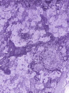 Doku paslı mor. Tasarım için doku ve arkaplan.