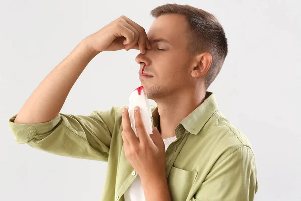Junger Mann Mit Nasenbluten Und Gewebe Auf Weißem Hintergrund Nahaufnahme — Stockfoto