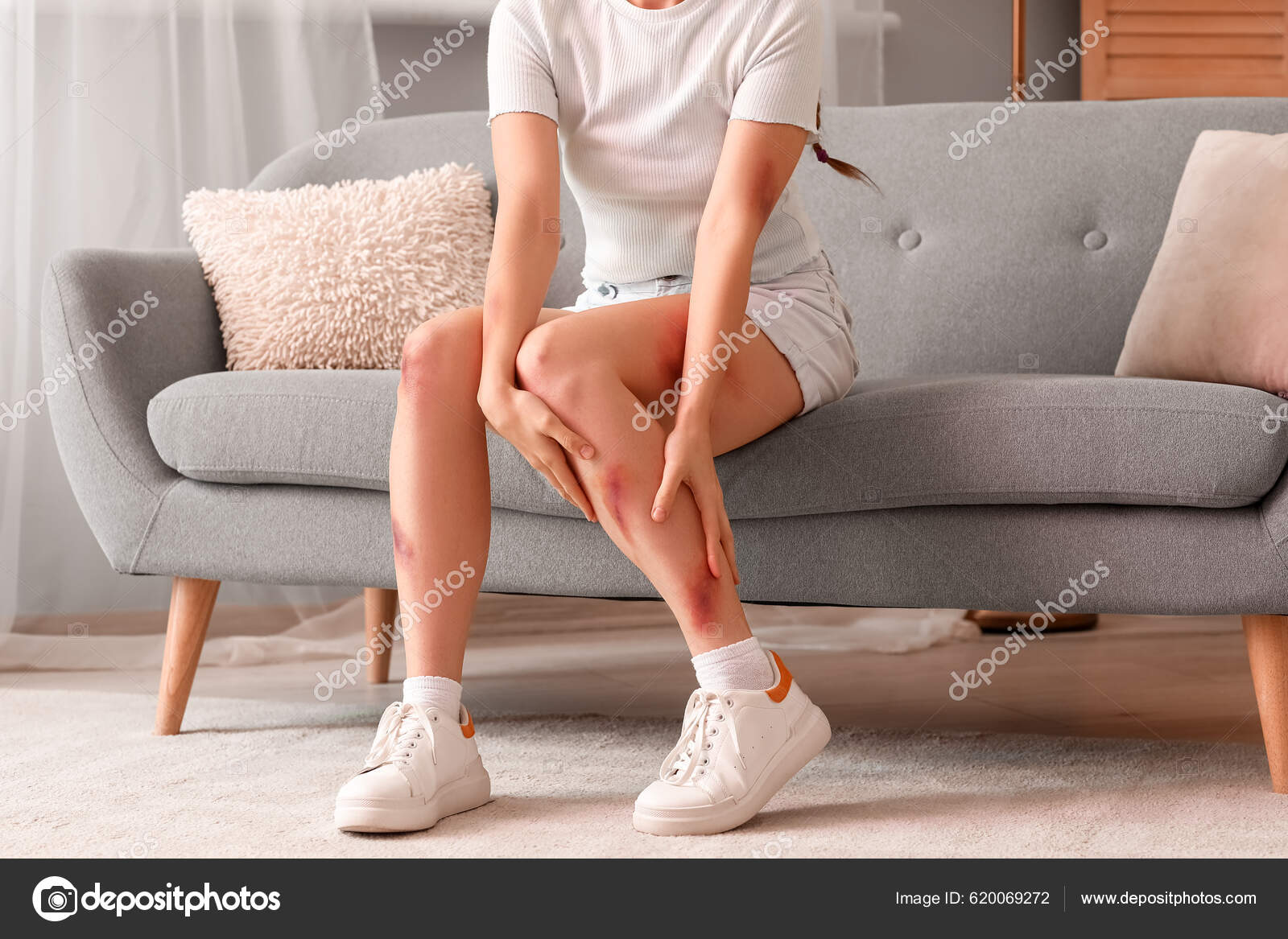 Ung Kvinde Med Blå Mærker Sidder Sofaen Derhjemme — Stock-foto © serezniy  #620069272