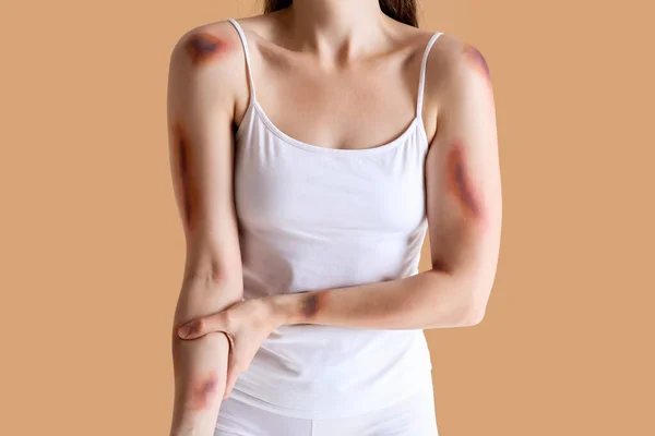 红褐色背景的年轻女子手臂受了伤 — 图库照片
