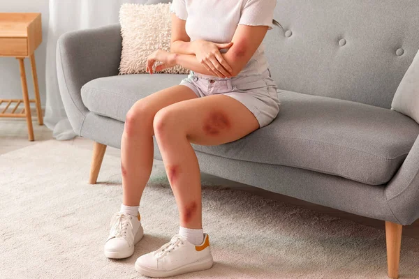 家里沙发上坐着擦伤的年轻女人 — 图库照片